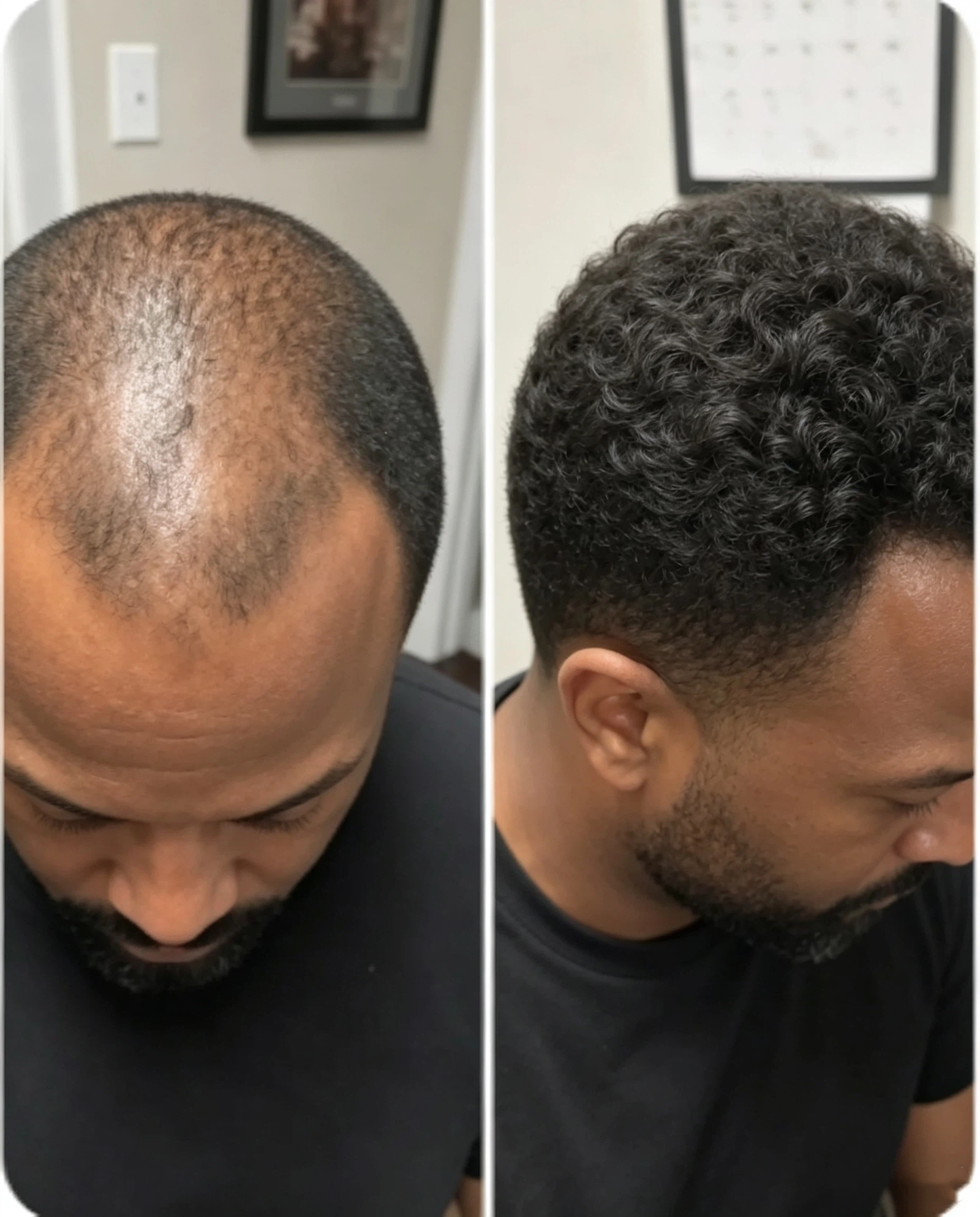 apply hair serum